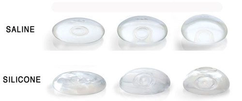 Khoe body mướt mát lan ngọc bị dân tình hỏi thẳng chị có đặt túi ngực không - 13