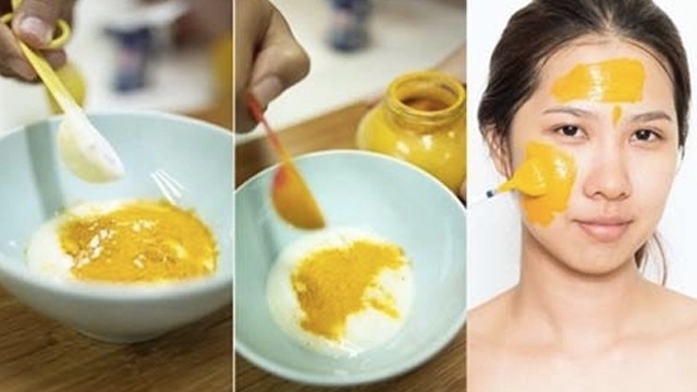 Không cần tốn tiền triệu vẫn tự tin lấp đầy sẹo rỗ với các nguyên liệu tự nhiên tại nhà - 3