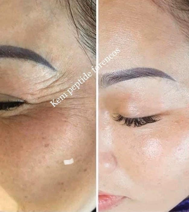 Mạnh hơn retinol mà không kích ứng kem dưỡng có 14 peptide vì căng bóng da cực đỉnh - 3