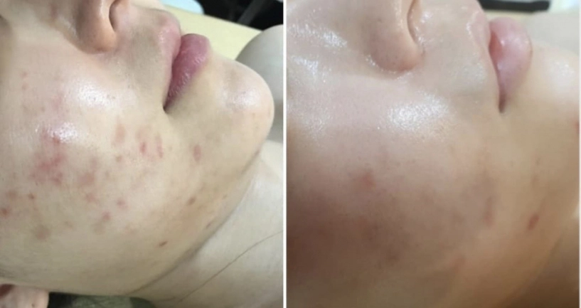 Mạnh hơn retinol mà không kích ứng kem dưỡng có 14 peptide vì căng bóng da cực đỉnh - 4