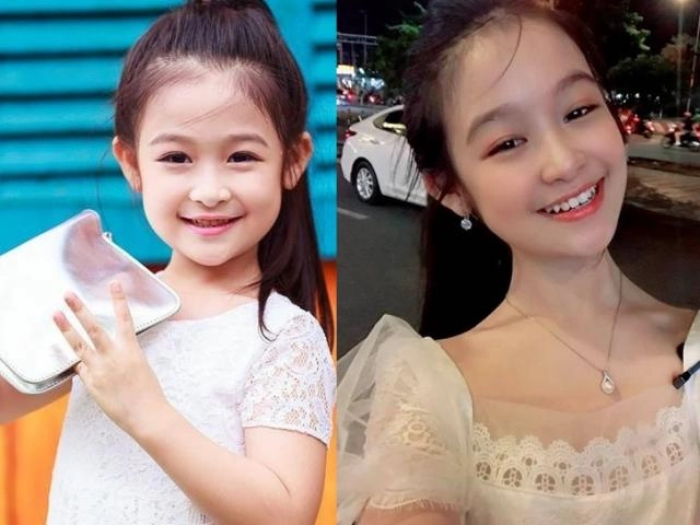 Nhìn gương mặt em bé có 4 nét này lớn lên thông minh giàu sang may mắn - 5