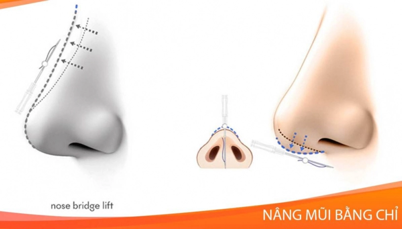 So ảnh ngày xưa không thấy nhã phương khác mấy sửa đúng một điểm là nhan sắc đã thăng hạng - 12