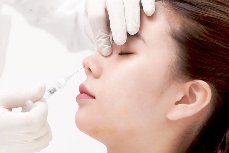 So ảnh ngày xưa không thấy nhã phương khác mấy sửa đúng một điểm là nhan sắc đã thăng hạng - 11