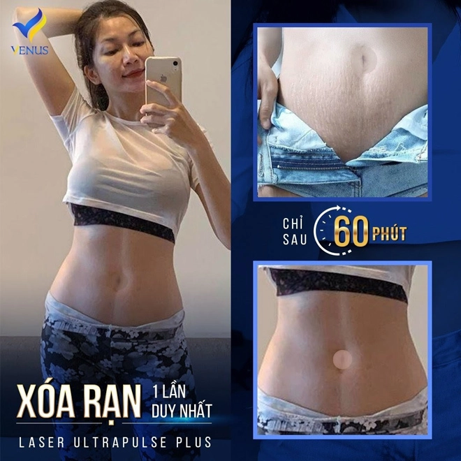 Vén màn công nghệ trị rạn siêu rẻ chuyên gia cảnh báo tiền mất tật mang - 2