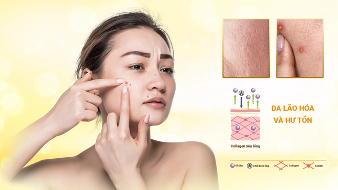 Viên uống the collagen extra plus của rosa bonita tái tạo da từ cấp độ tế bào - 1