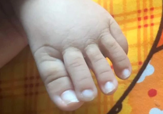 Ảnh ngón chân dài như tay của con mới sinh gây sốc người mẹ cuối cùng thú nhận sự thật - 3