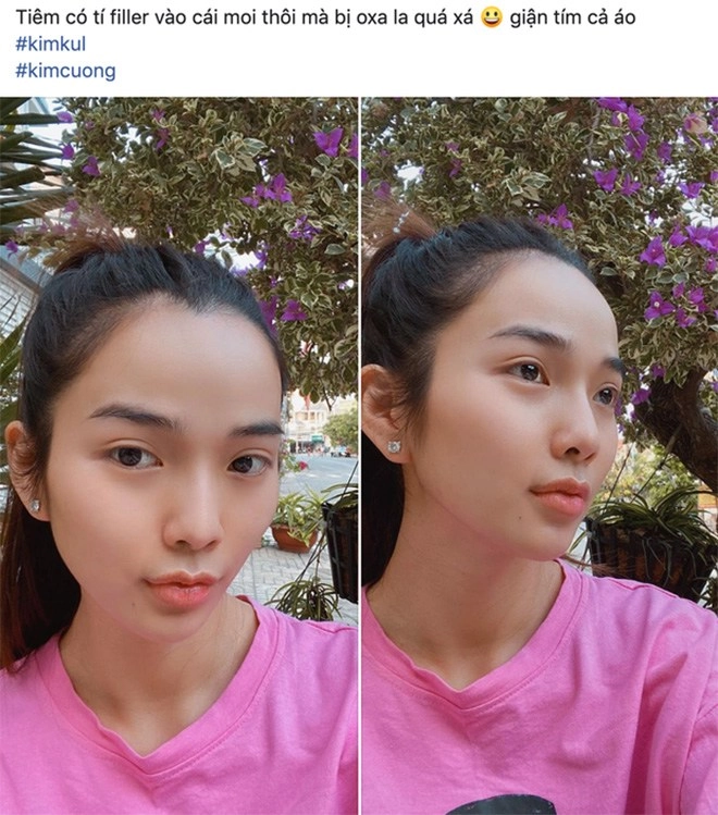 Đu mốt bơm môi gợi cảm vợ ưng hoàng phúc bị chồng la có cô dày cộm cứng đờ - 7