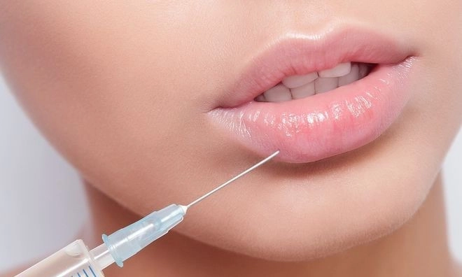 Đu mốt bơm môi gợi cảm vợ ưng hoàng phúc bị chồng la có cô dày cộm cứng đờ - 11