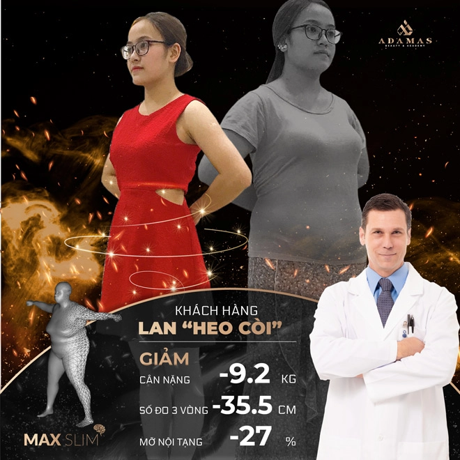 Giảm béo tại adamas và những màn lột xác đổi đời - 2