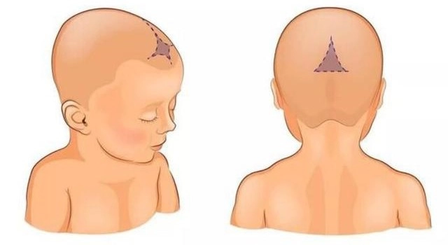 5 biêu hiên ơ thop tre sơ sinh bao hiêu sưc khoe be đang găp vân đê - 1