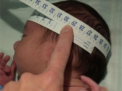 5 biêu hiên ơ thop tre sơ sinh bao hiêu sưc khoe be đang găp vân đê - 3