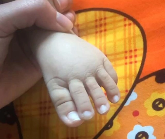 Ảnh ngón chân dài như tay của con mới sinh gây sốc người mẹ cuối cùng thú nhận sự thật - 1