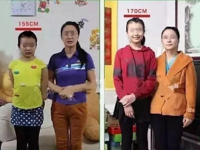 Bố 1m80 mẹ 1m68 nhưng con thấp nhất lớp biết lý do thì đã quá muộn - 6