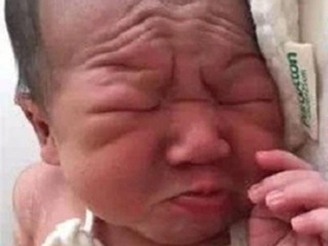 Con sinh ra quá xấu xí mẹ chán nản bố nghi ngờ vài tháng sau không ngờ đẹp như tiên - 1