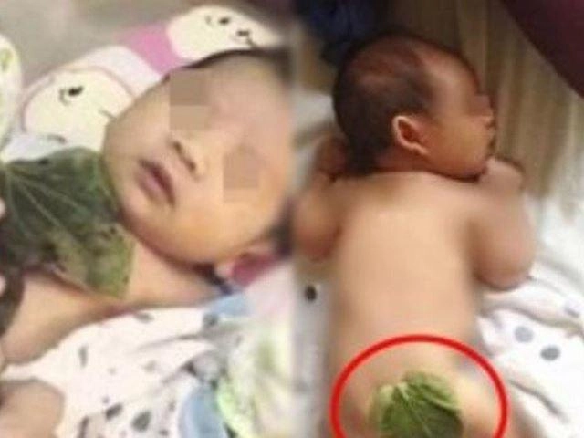 Đắp lá trầu không cho trẻ sơ sinh có tác dụng gì - 3