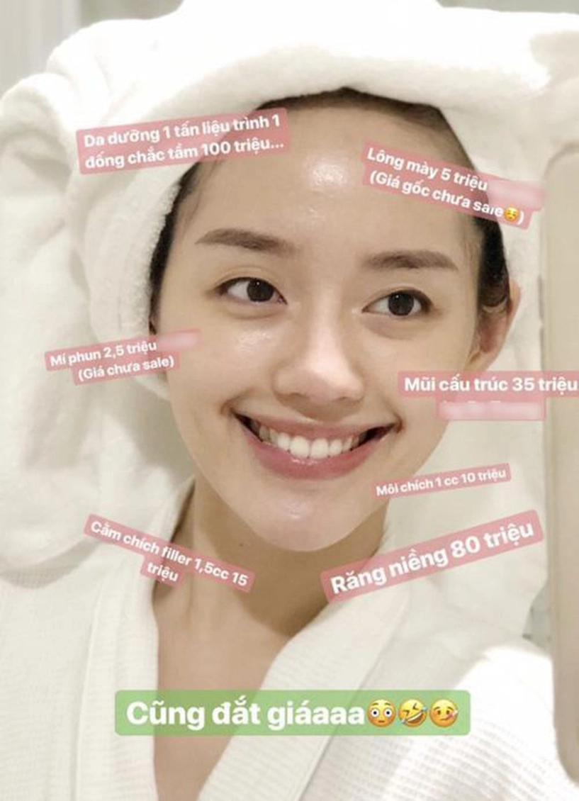 Đu mốt bơm môi gợi cảm vợ ưng hoàng phúc bị chồng la có cô dày cộm cứng đờ - 5