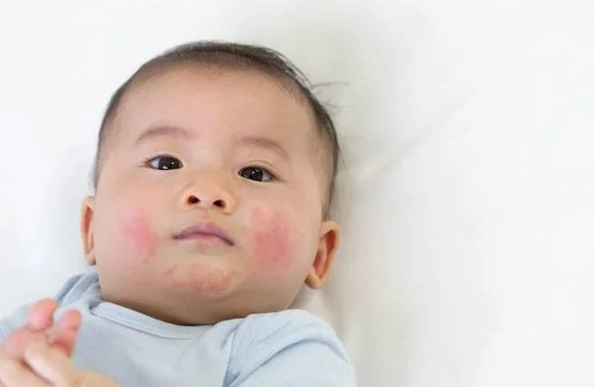 Mùa đông này mẹ đã chọn được loại kem dưỡng ẩm phù hợp cho bé yêu chưa - 1