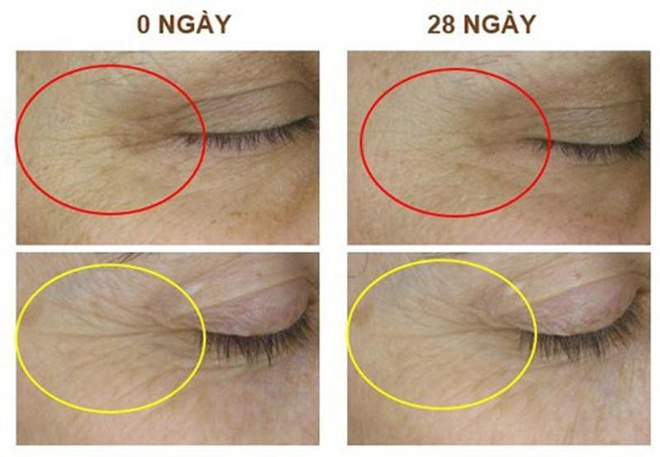 Nature queen ứng dụng ah8 - thành tựu giải nobel thế giới trong việc giảm nhăn trẻ hóa da - 2