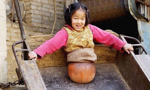 Nhan sắc xinh đẹp vịt hoá thiên nga của cô bé nửa thân dưới là quả bóng rổ - 3