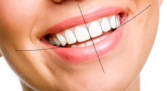 Thiết kế nụ cười bước tiến công nghệ tại queen smile - 2