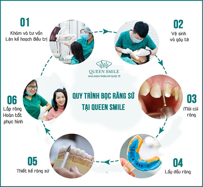 Thiết kế nụ cười bước tiến công nghệ tại queen smile - 4