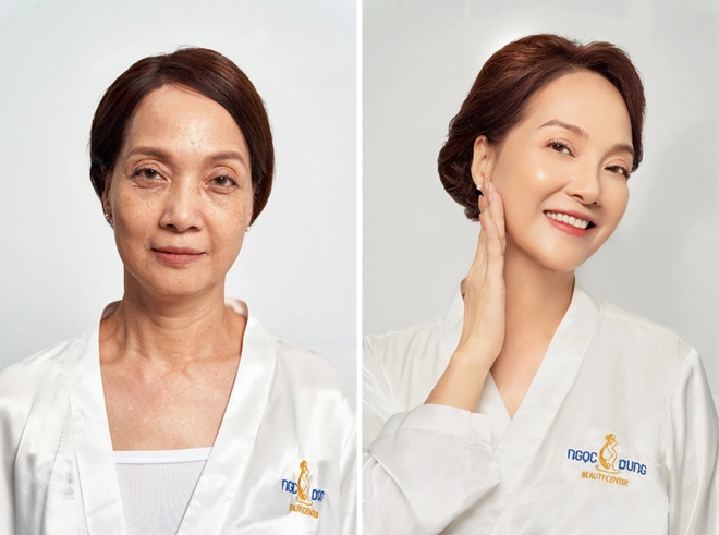 Tmv ngọc dung kết hợp cùng loạt nghệ sĩ ra mắt bộ đôi công nghệ đột phá sau 22 năm - 4