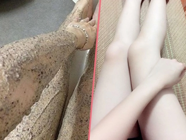 Tốn cả chục triệu đi spa trị nám không sạch 3 cách trị nám bằng mật ong sẽ giúp bạn - 6