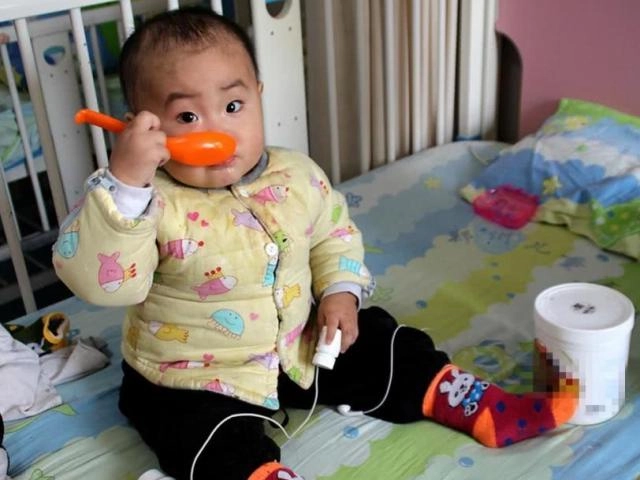 Triệu chứng và giải pháp dinh dưỡng dành cho trẻ thấp còi nhẹ cân - 3