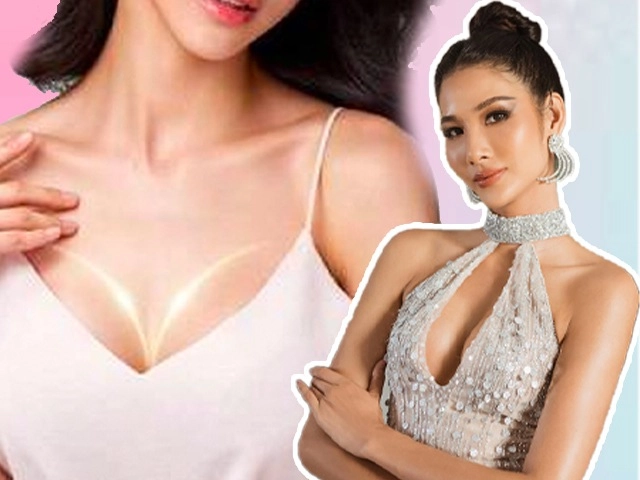 Đệ nhất chân dài đài loan lâm chí linh mặt cứng đờ vì tiêm botox lố tay - 15