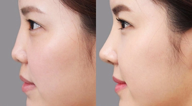 Ăn diện và make-up khá sến thuỷ tiên vẫn ghi điểm nhờ điểm vàng của gương mặt - 8