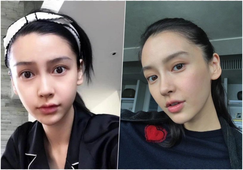 Angelababy thời thanh xuân mặt tròn phúng phính giờ u35 gầy nhom lộ cả rổ khuyết điểm - 14