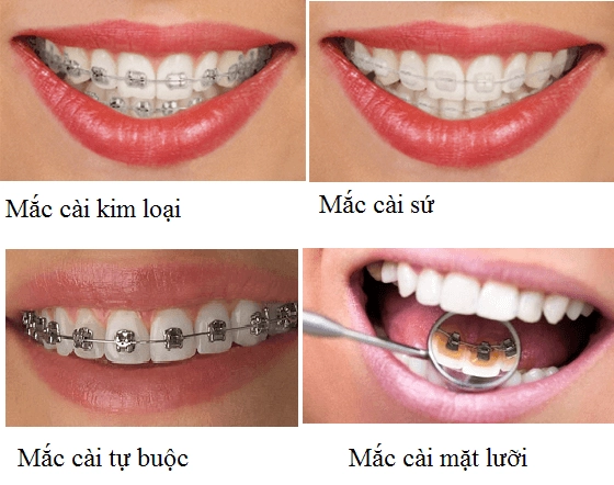 Không đụng dao kéo loạt hoa hậu rủ nhau sửa một điểm trên gương mặt lên đời luôn nhan sắc - 26