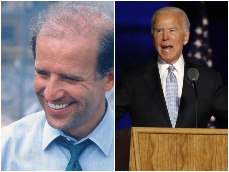 Quý ông cũng cần làm đẹp tổng thống trump cấy tóc tiền tỷ ông biden bị nghi đại trùng tu - 6