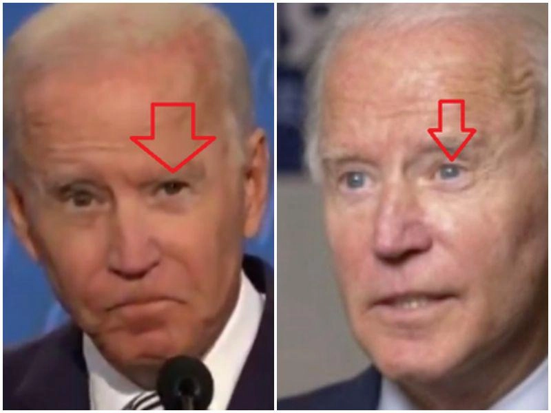 Quý ông cũng cần làm đẹp tổng thống trump cấy tóc tiền tỷ ông biden bị nghi đại trùng tu - 8