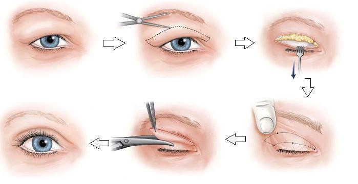 Tìm ra bộ phận trụ nhan của lý nhã kỳ không phải cặp má mà là cửa sổ tâm hồn - 10