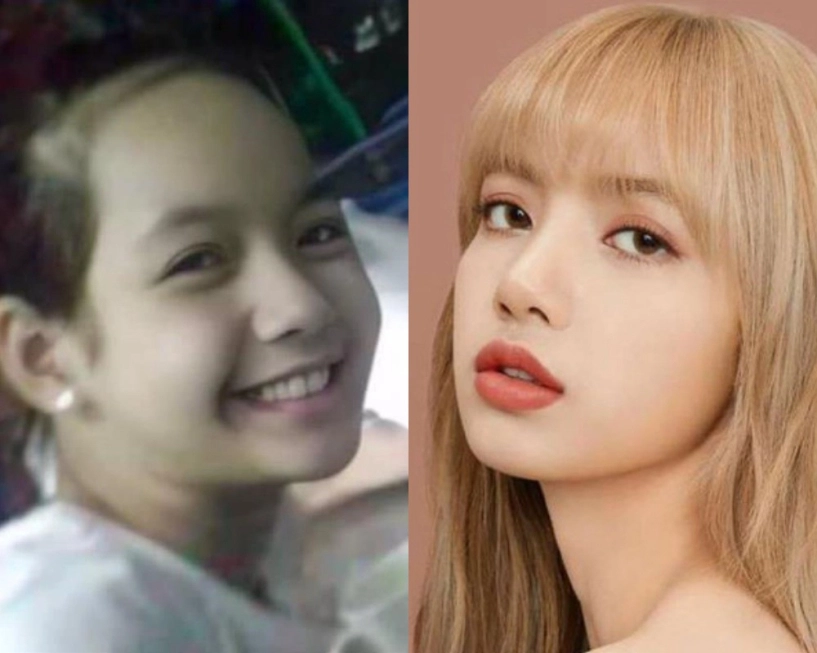 Đỉnh cao thẩm mỹ như không thẩm mỹ tại hàn blackpink sửa gần hết riêng lisa tiêu gần 1 tỷ - 3
