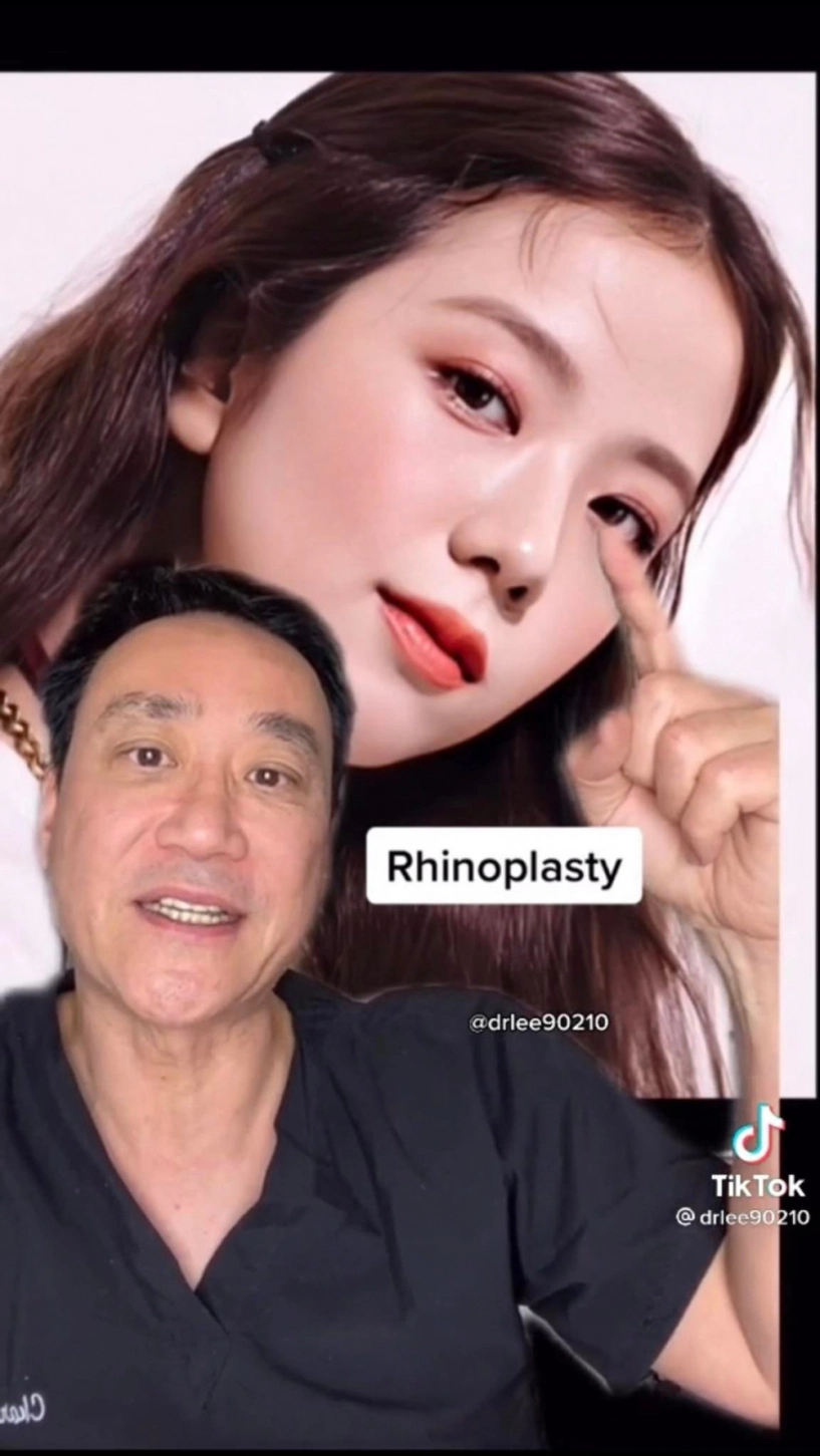 Đỉnh cao thẩm mỹ như không thẩm mỹ tại hàn blackpink sửa gần hết riêng lisa tiêu gần 1 tỷ - 9