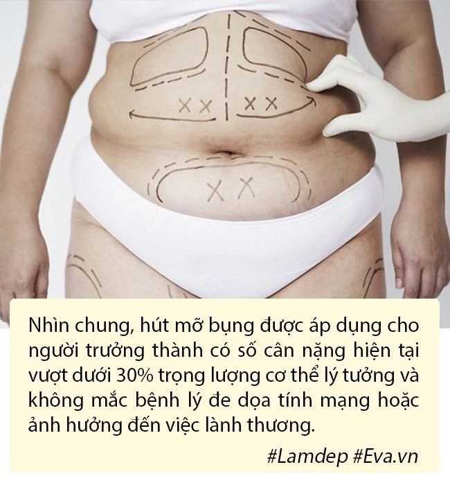 Hút mỡ tạo hình thành bụng bí quyết vàng cho hội chị em nghiện diện bikini - 4