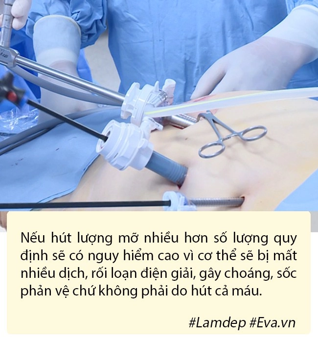 Hút mỡ tạo hình thành bụng bí quyết vàng cho hội chị em nghiện diện bikini - 5