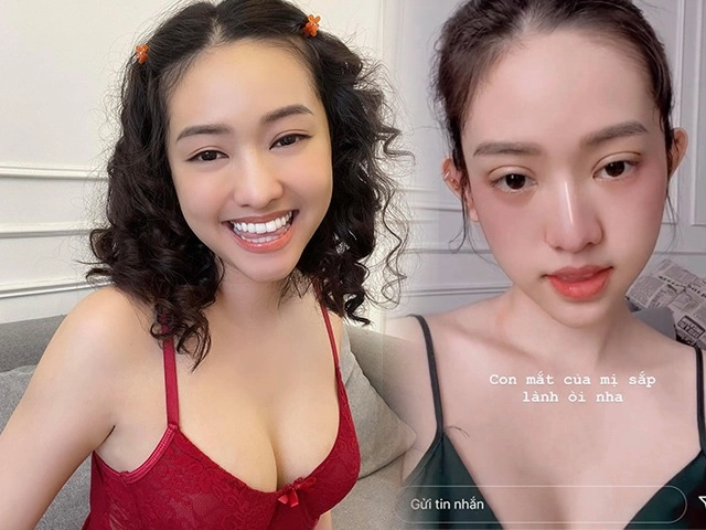Shock miss universe 2015 công khai tiêm chích để trẻ mãi với thời gian - 16