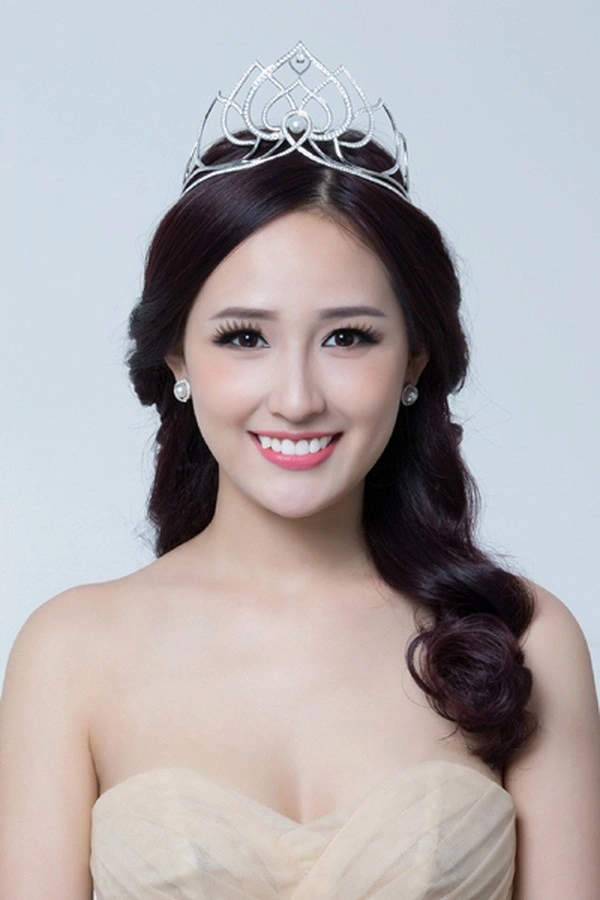 Bị nói niềng răng để bọc sứ mai phương thuý phản ứng ngay lập tức - 2