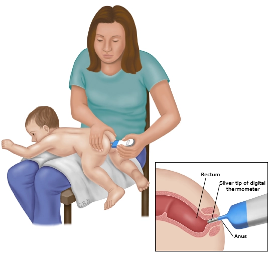 Cách đo nhiệt độ cho trẻ sơ sinh phổ biến nhất - 3