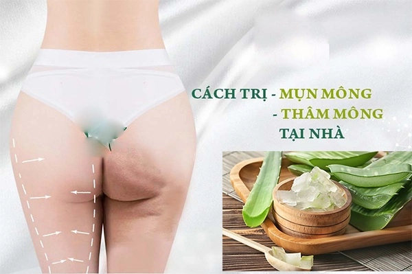 Cách trị mụn mông và thâm mông hiệu quả an toàn tại nhà - 6