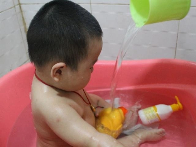 Con tắm xong cả người đỏ rực như tôm luộc mẹ bàng hoàng khi bác sĩ chỉ ra sai lầm - 5