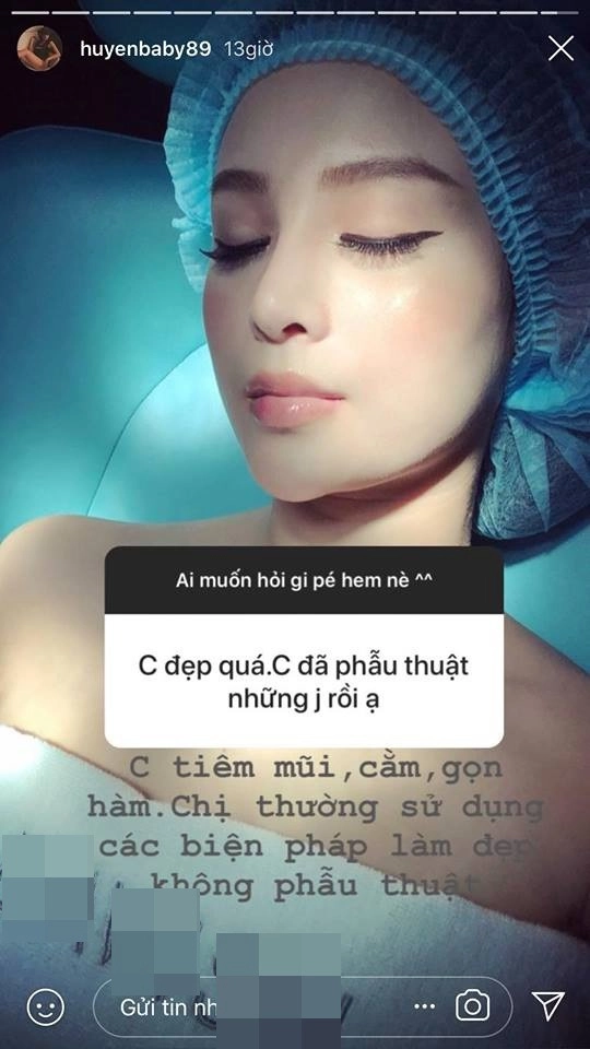 Huyền baby khoe đôi gò bồng đào nảy lửa nhưng chiếc mũi ửng đỏ mới đáng chú ý - 5
