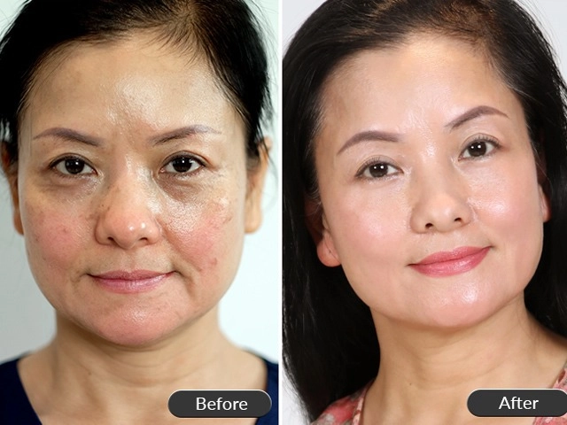 Huyền baby khoe đôi gò bồng đào nảy lửa nhưng chiếc mũi ửng đỏ mới đáng chú ý - 9