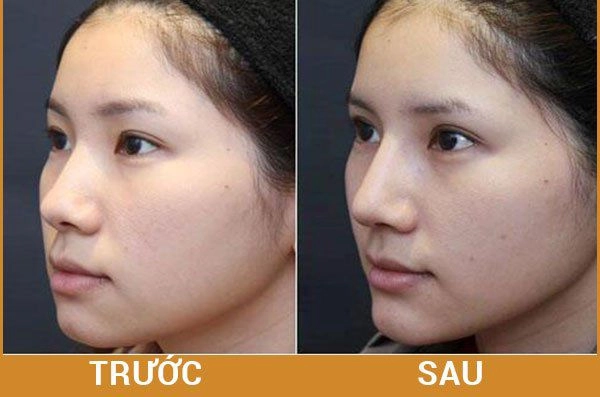 Huyền baby khoe đôi gò bồng đào nảy lửa nhưng chiếc mũi ửng đỏ mới đáng chú ý - 10
