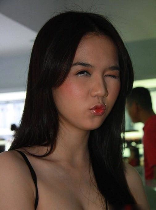 Loạt mỹ nhân bất chấp nguy hiểm bơm chất làm trắng da để vịt hóa thiên nga - 4