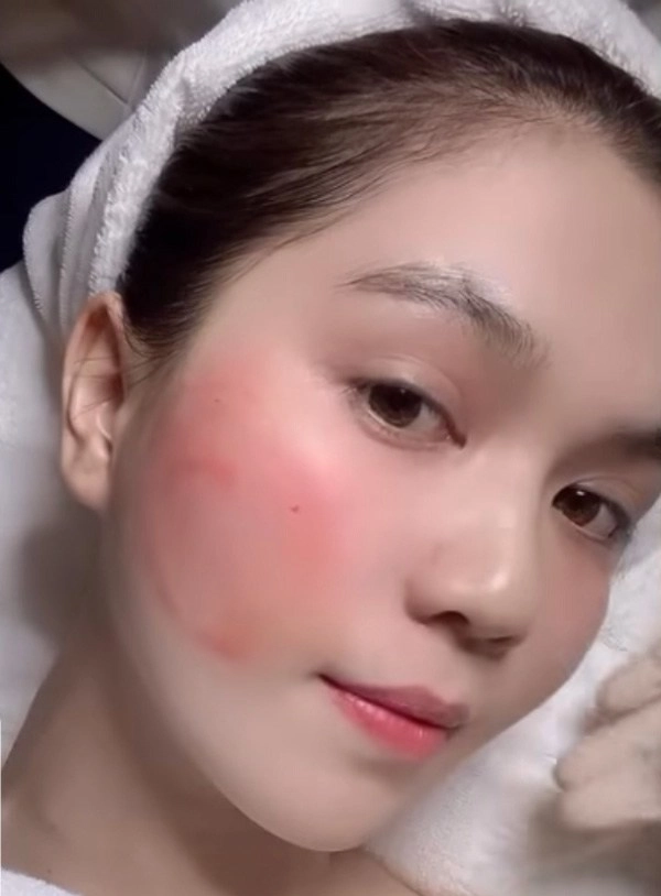 Ngọc trinh xuất hiện với gương mặt chảy máu chuyện gì thế này - 1
