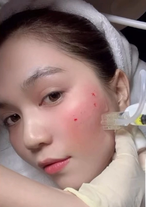 Ngọc trinh xuất hiện với gương mặt chảy máu chuyện gì thế này - 2